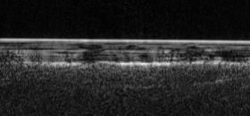 Obraz z radaru Mars Express. Cienka biała linia to pokrywa lodowa. Poniższe struktury to sedymentacje lodowo-pyłowe. Pod nimi jasny wąski obszar to najpewniej jezioro z płynną wodą.