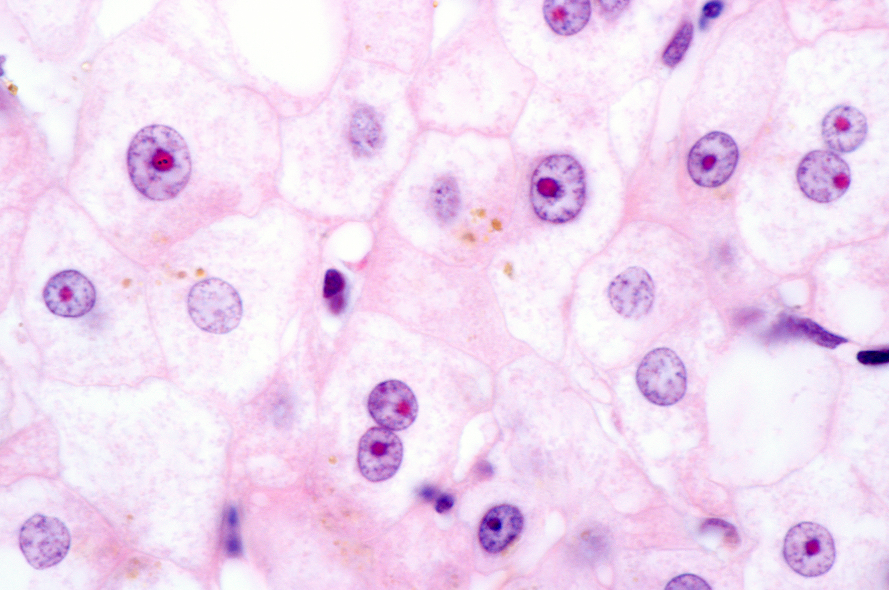 Dodatkowe chromosomy mogą pomagać nowotworom się rozprzestrzeniać