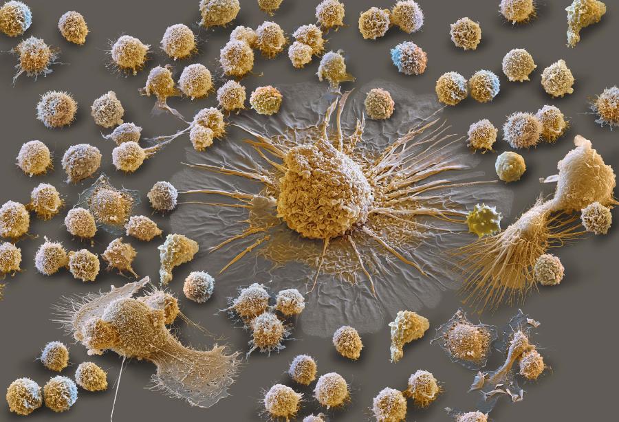 Uwidoczniona w mikroskopie elektronowym burza cytokin. Małe komórki – leukocyty, duże – makrofagi.