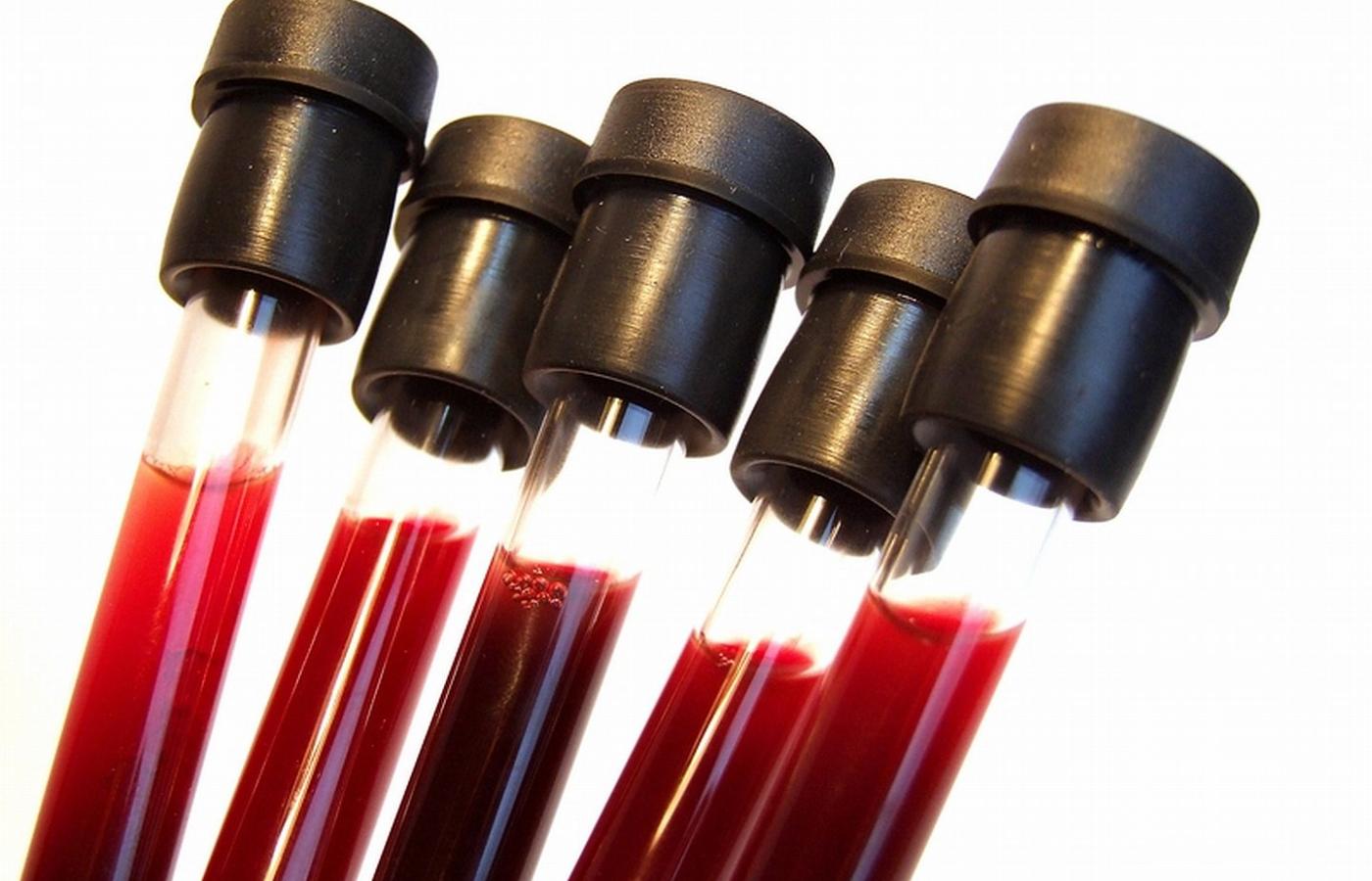 Oddajesz do badania próbkę krwi, by dowiedzieć się, czy znalezione w niej markery świadczą o początku nieodczuwanej jeszcze choroby. To przyszłość, ale być może już niedaleka.