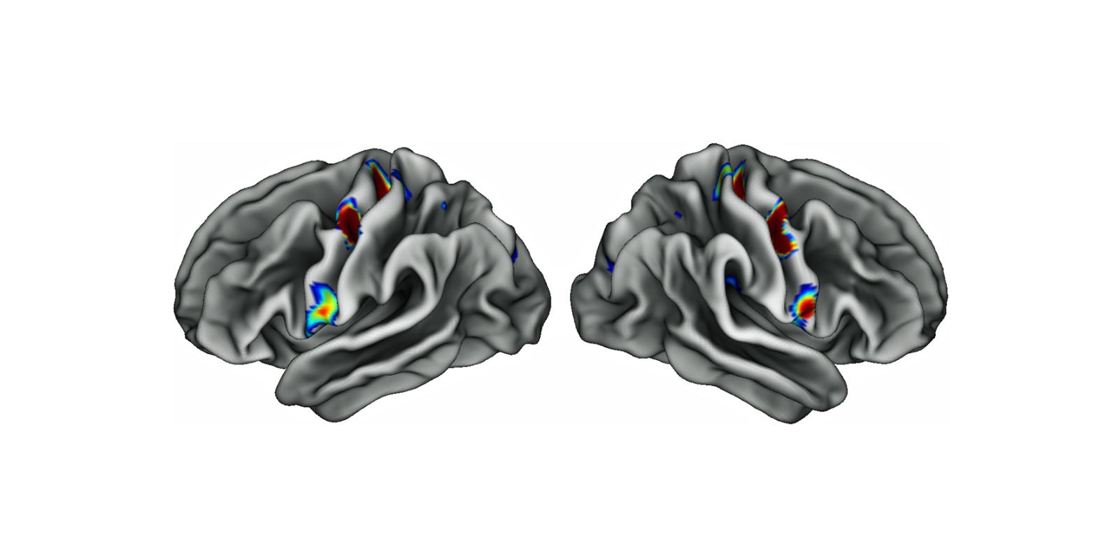 Trzy kolorowe plamy na każdej połowie mózgu to specjalne obszary w korze ruchowej, które są połączone z rejonami odpowiedzialnymi za myślenie, planowanie i kontrolę podstawowych funkcji organizmu, takich jak bicie serca. Im intensywniejszy kolor, tym gęstsze połączenia.