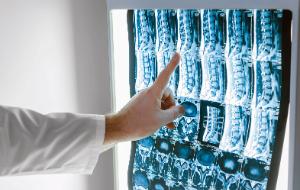 W Polsce jest 4,3 tys. radiologów, zdecydowanie mniej, niż wymaga rosnąca liczba badań.