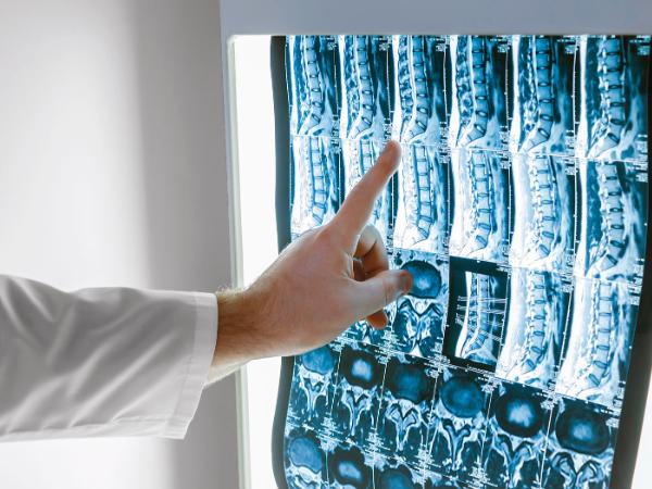 W Polsce jest 4,3 tys. radiologów, zdecydowanie mniej, niż wymaga rosnąca liczba badań.