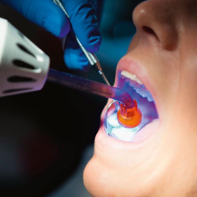 Lampa polimeryzacyjna utwardzająca plomb.