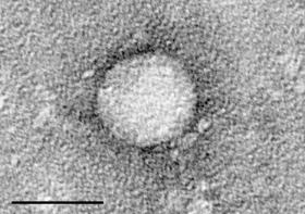 Wirus zapalenia wątroby typu C widziany w mikroskopie elektronowym.