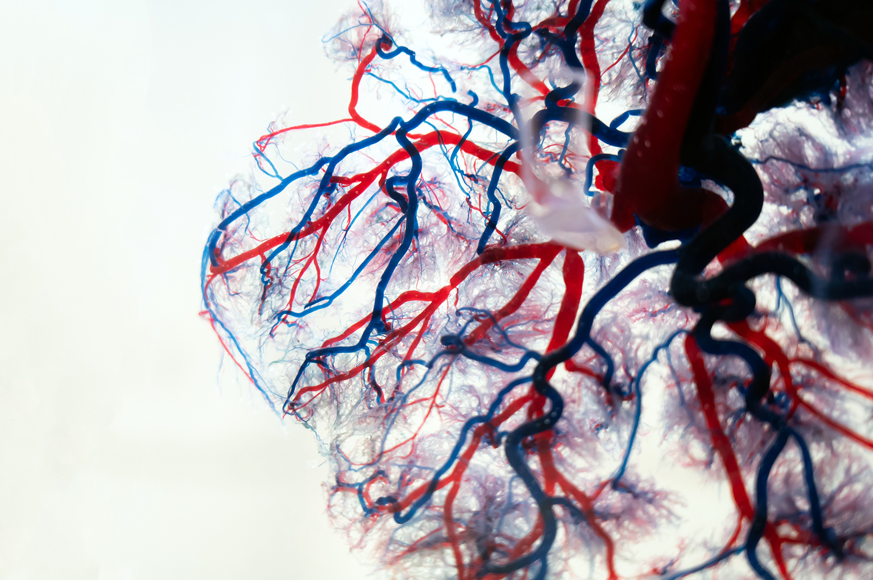 Magnetyczny mikrocewnik może zrewolucjonizować leczenie udarów i guzów mózgu