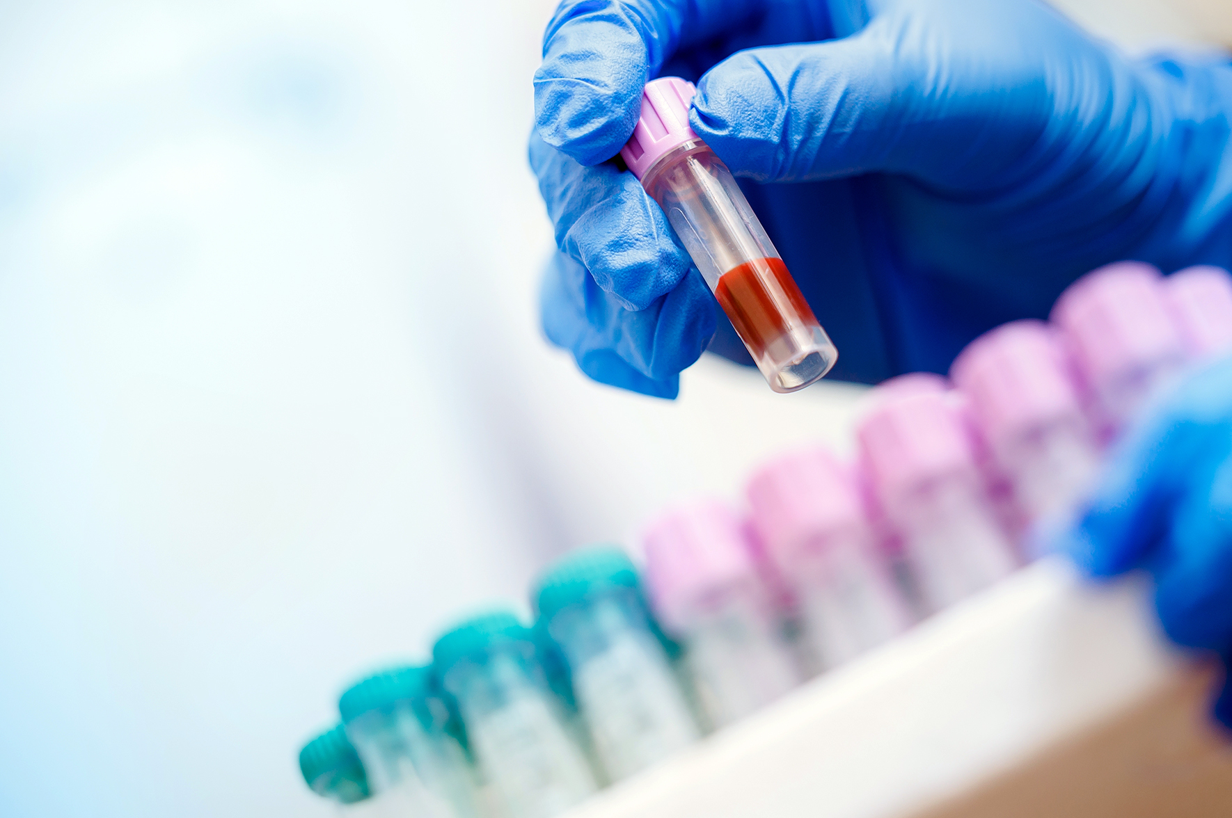 Alzheimer: Badanie krwi ma szacować, kiedy wystąpią objawy w grupach ryzyka