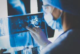 Paradoksalnie wzrost zapadalności na nowotwory wynika również ze skuteczniejszej opieki medycznej.