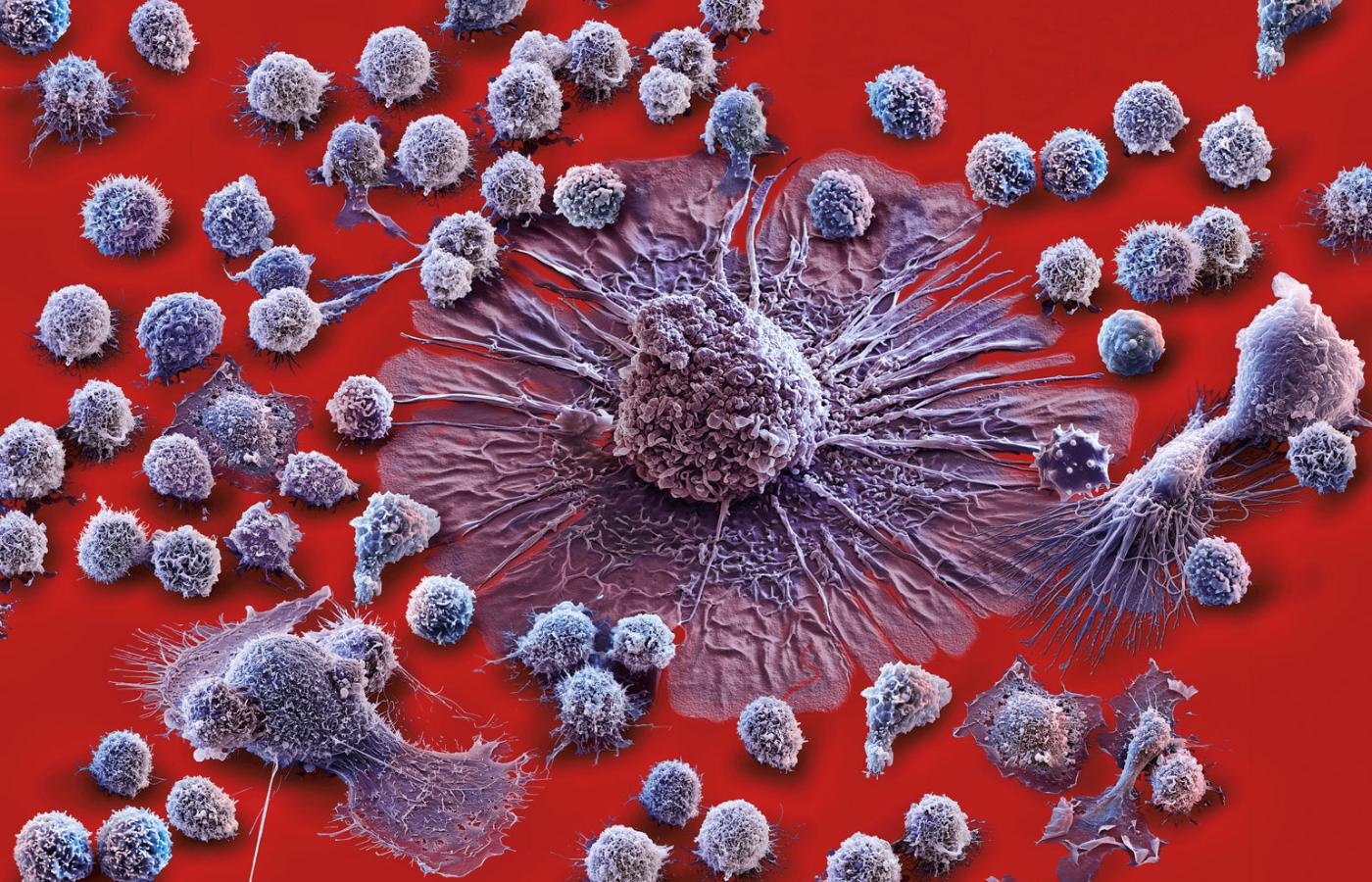 Ilustracja burzy cytokinowej, czyli ostrej reakcji immunologicznej, w wyniku której komórki obronne organizmu atakują również sam organizm. Na fot.: mniejsze komórki to różnego rodzaju leukocyty, a większe – makrofagi.