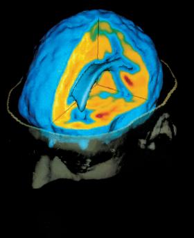 Komputerowe analizy danych pochodzących ze skanerów mózgu zawierają błędy.