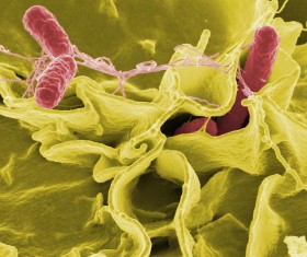 Pałeczki Salmonella przodują  w raportach epidemiologicznych dotyczących zatruć pokarmowych.