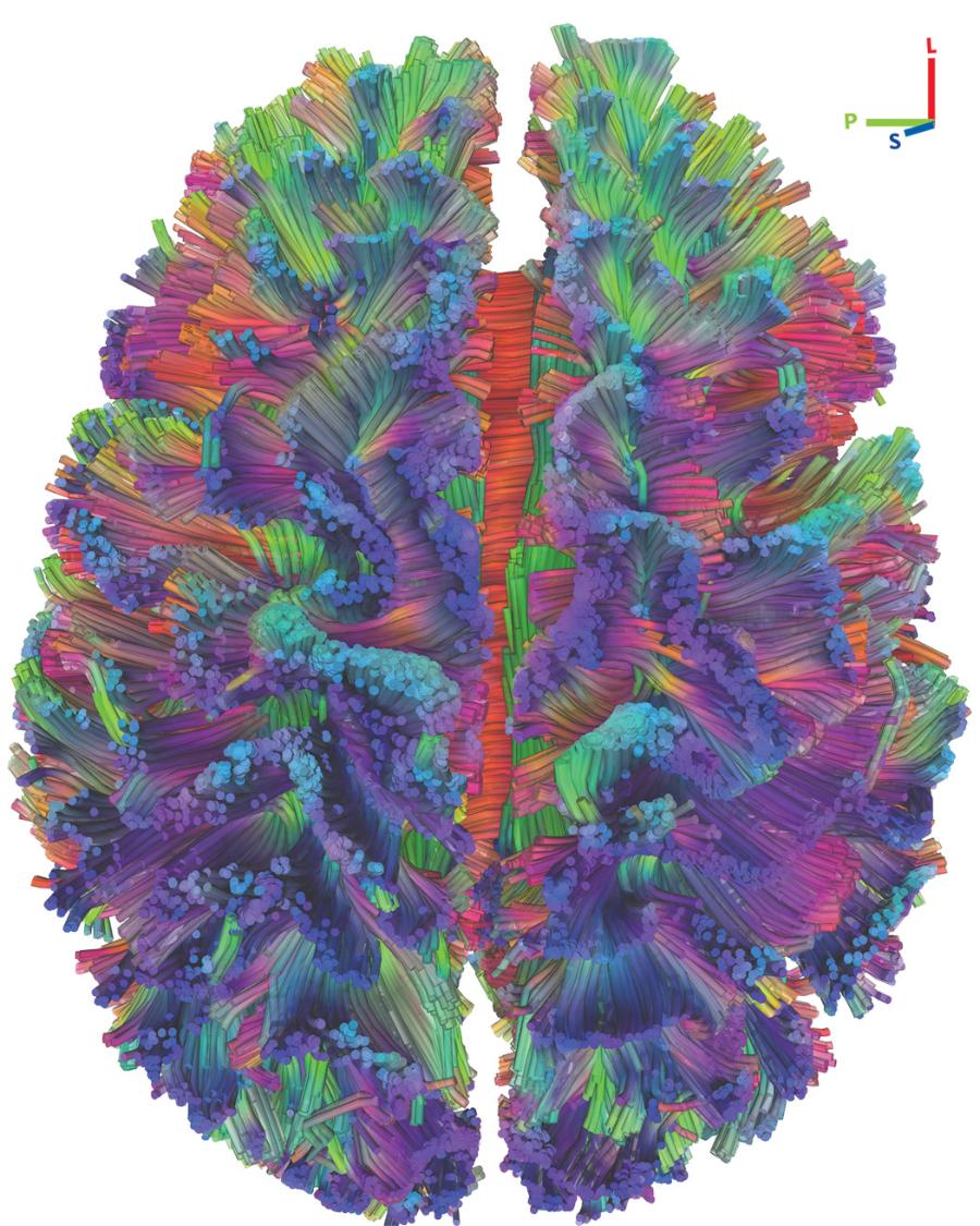 Bezlik połączeń istoty białej na tym obrazie tomograficznym przedstawia dane wykorzystane do stworzenia modelu sieci neuronów mózgu. Tego typu funkcjonalne sieci leżą u podłoża zadań poznawczych przeprowadzanych w mózgu.