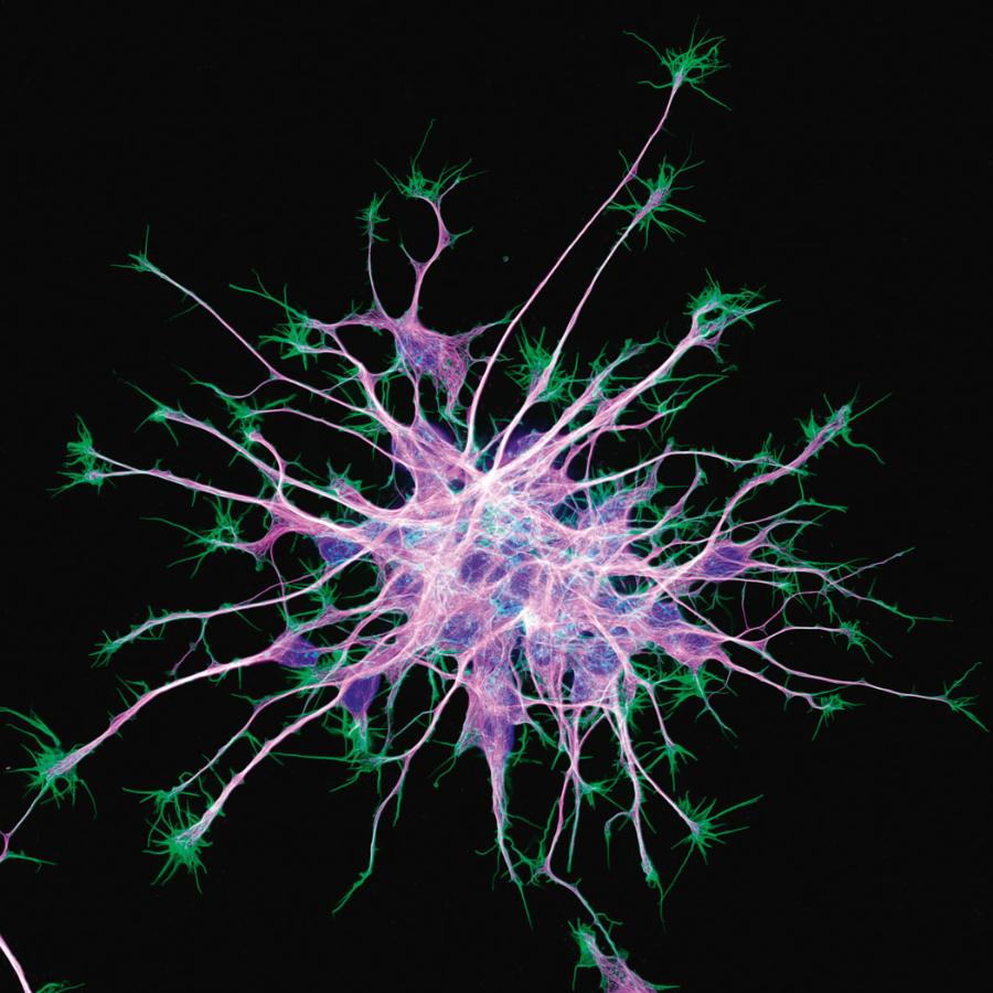 Komórki iPSC zróżnicowane do neuronów. Można to zrobić w hodowli poprzez odpowiednią suplementację pożywki wzrostowej.