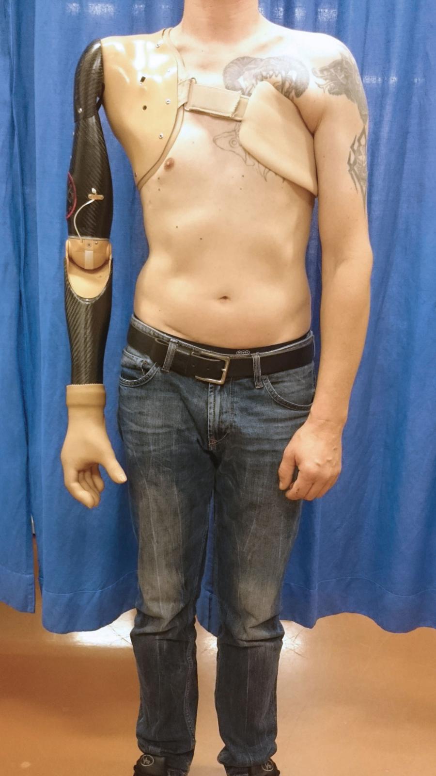 Zdjęcie układu sensorycznego i zrobotyzowanej protezy obsługiwanej przez pacjenta, powstałe w ramach badań Imperial College London.