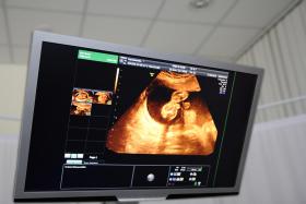 Na Islandii badania prenatalne są darmowe. Odbywają się one w formie testu kombinacyjnego: badanie krwi oraz ultrasonografia.
