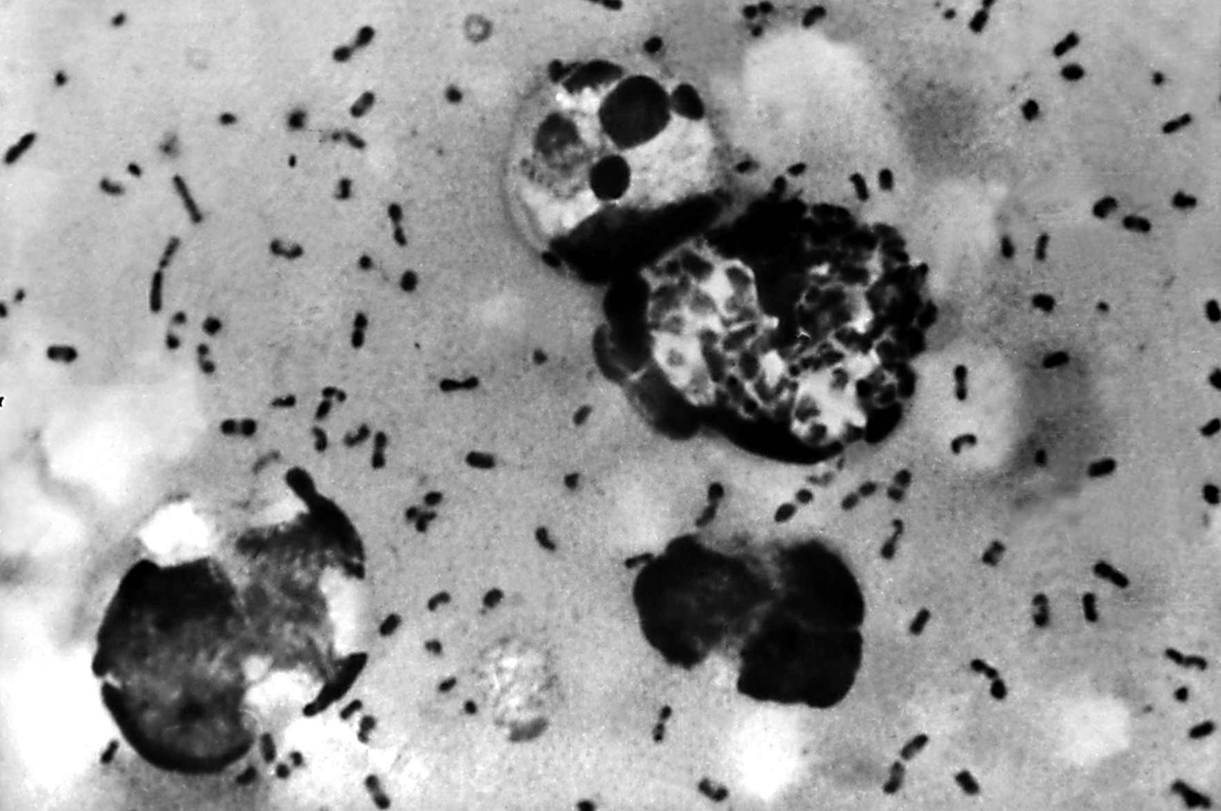 Dżuma na Syberii? Możliwe, ale ryzyko wybuchu epidemii jest minimalne