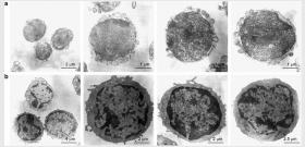 Obraz mikroskopowy komórek VSEL (u góry). Dolny rząd przedstawia komórki hematopoetyczne.