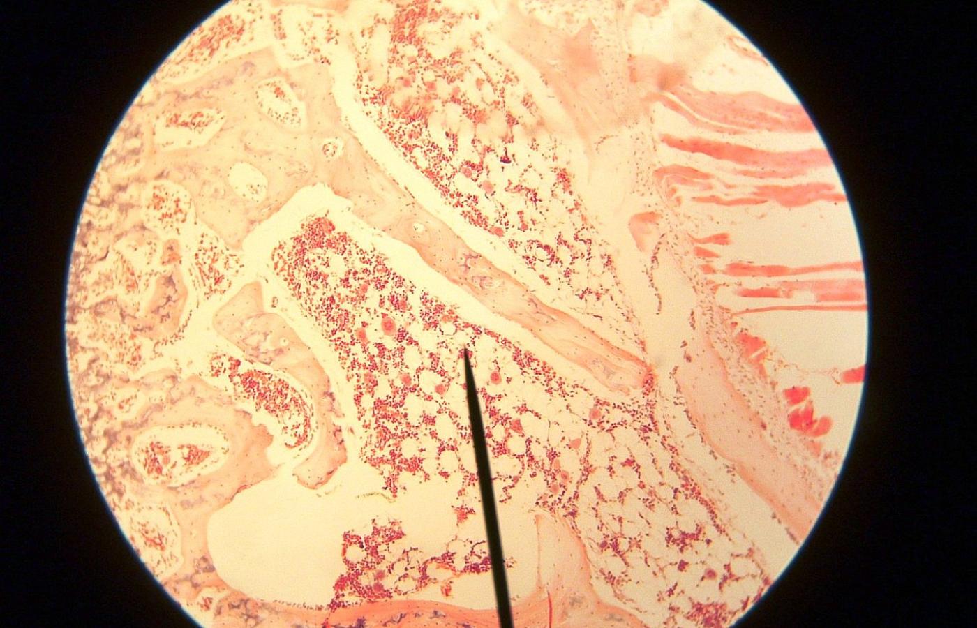 Obraz mikroskopowy szpiku kostnego.
