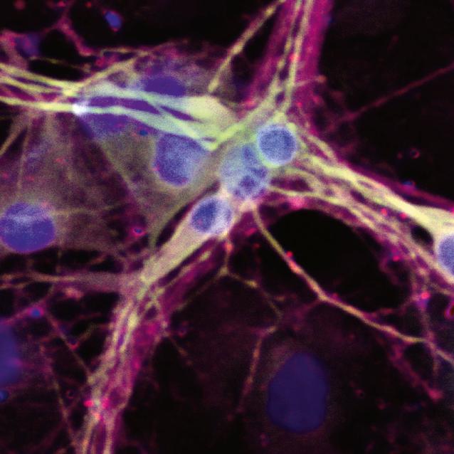 Znakowanie fluorescencyjne neuronów.