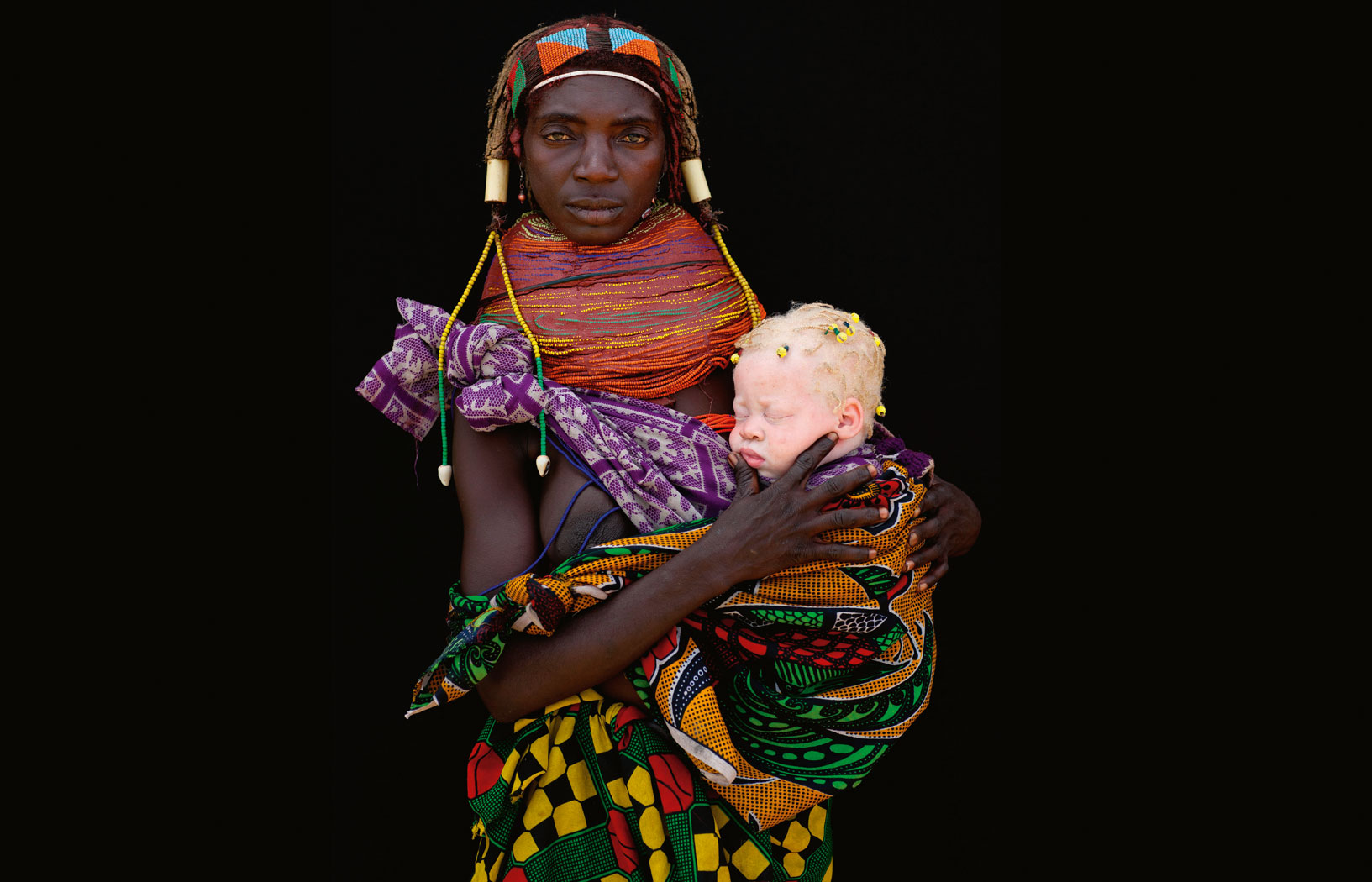 Polowania na albinosów