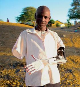 Proteza dla ofiary afrykańskich min