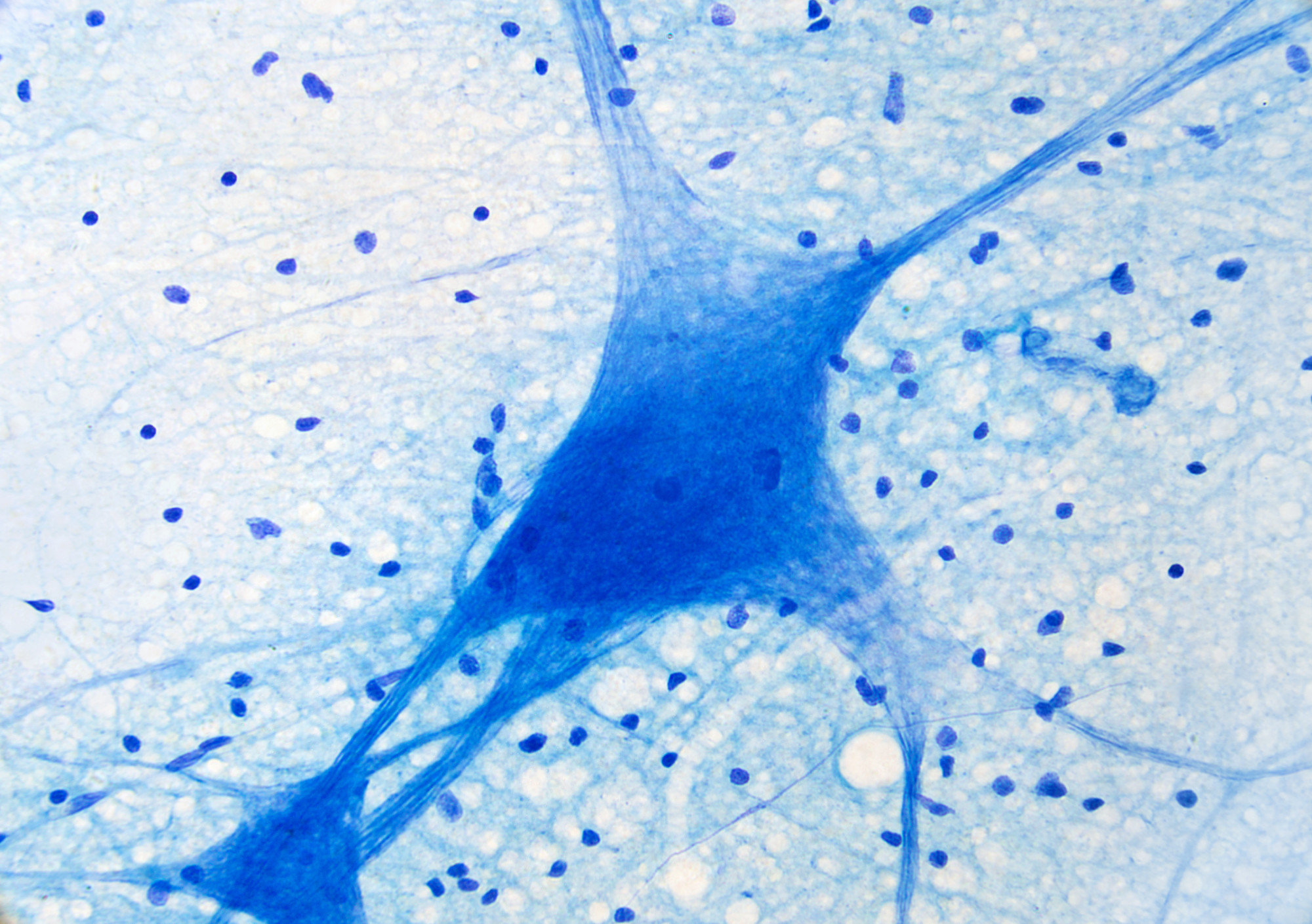 Ciągłe próby, częste porażki. Nowy wgląd w regenerację mózgu