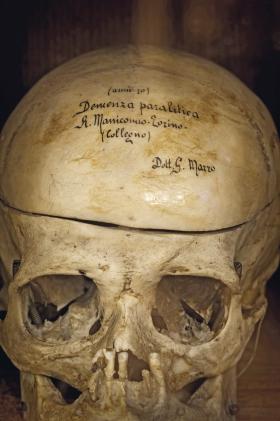 Eksponat z muzeum antropologii kryminalnej, założonego przez Lombroso w 1876 r.