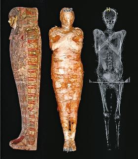 Po prześwietleniu mumii ze zbiorów Muzeum Narodowego w Warszawie odkryto, że zmumifikowana kobieta była w ciąży.