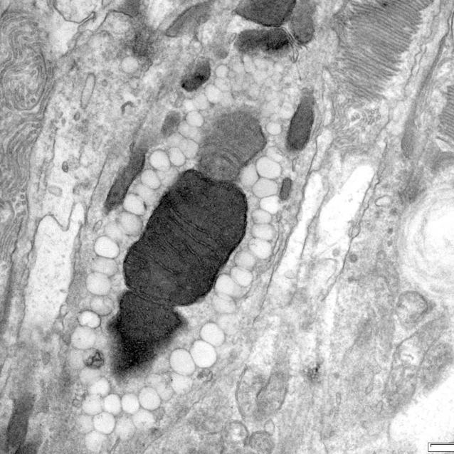 Kropelki oleju otaczające wielkie mitochondrium w oku empidonki oliwkowej
Z “A Novel Cellular Structure in the Photoreceptors of Insectivorous Birds,”, by Luke P. Tyrrell i in., Preprint przesłany do Biorxiv 15 lutego 2019