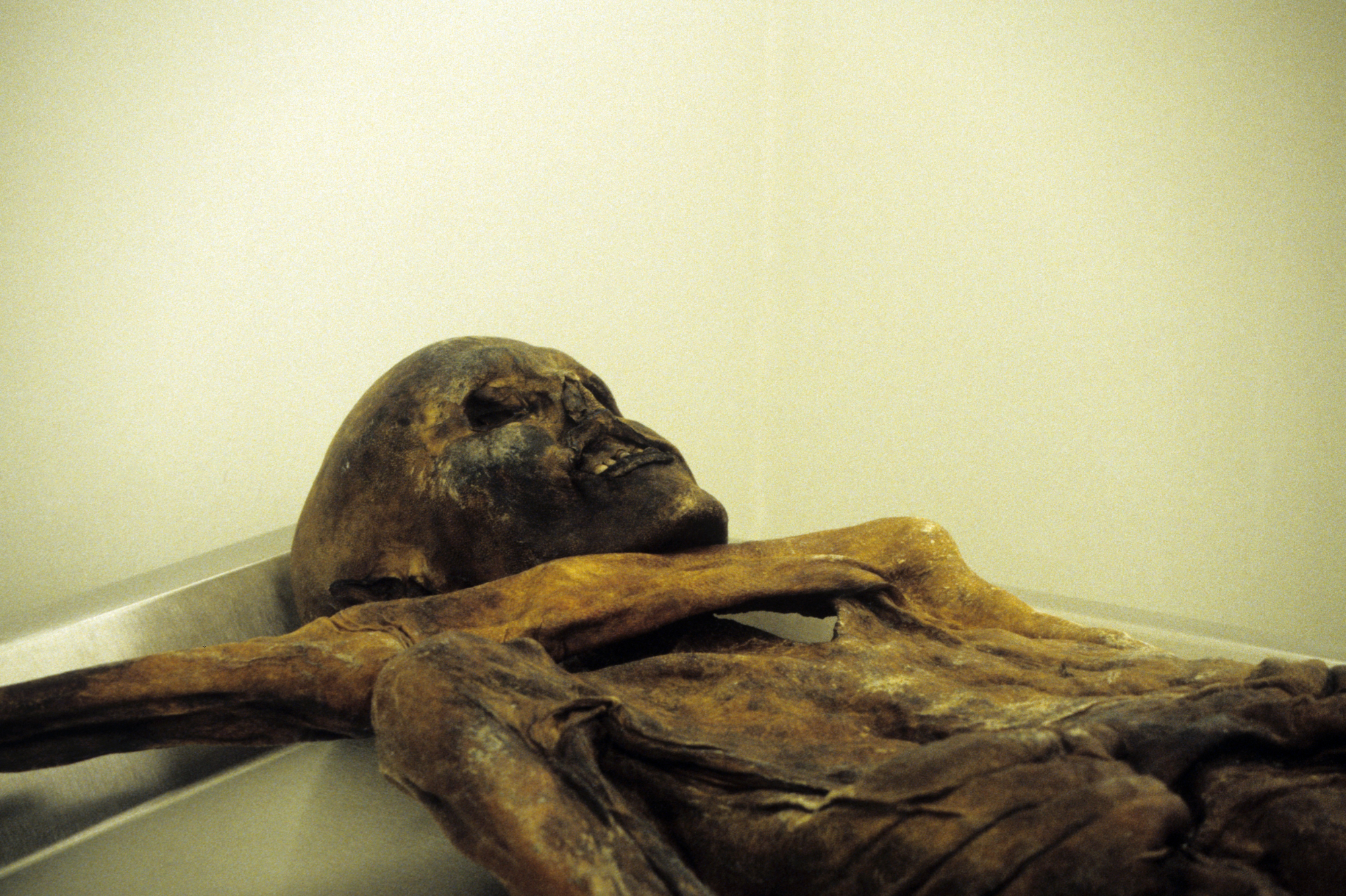Ötzi: naukowcy przeanalizowali jego mikrobiotę. Niektóre mikroorganizmy wciąż są zdolne do życia
