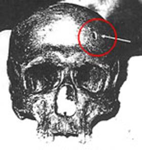 Krążąca w Internecie rzekoma czaszka Celestyna - przebita ostrym narzędziem?