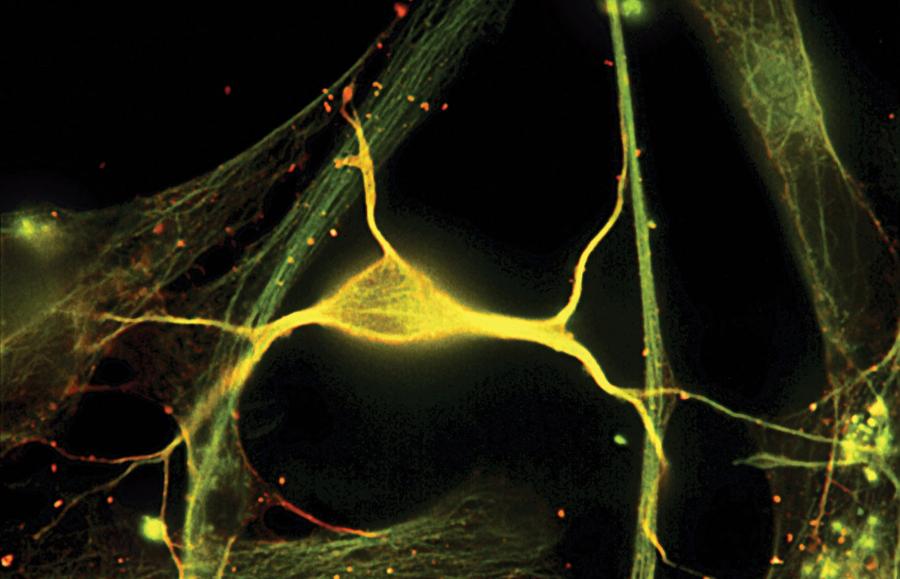 Neuron, czyli komórka nerwowa (żółta) w hipokampie – strukturze mózgu, stanowiącej ośrodek pamięci długotrwałej – jest wspierany przez białka (zielone i czerwone).