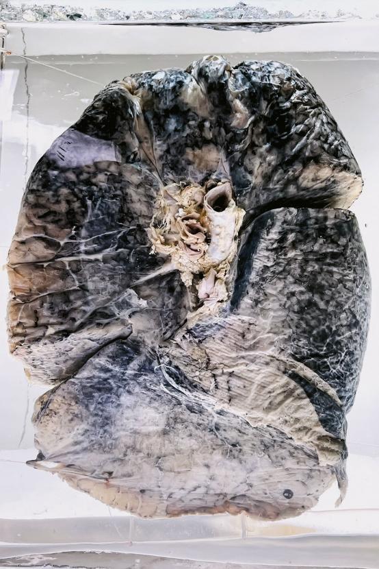 Muzealny eksponat przedstawiający płuca górnika.