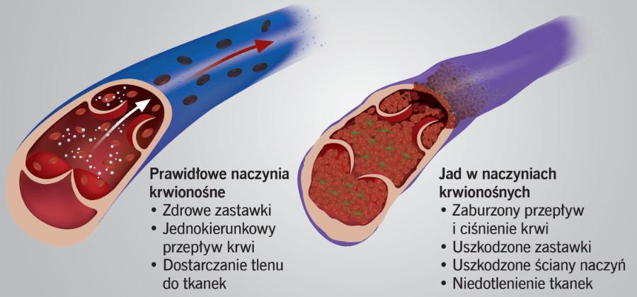 Jad węża zaburza krążenie krwi w organizmie ofiary.