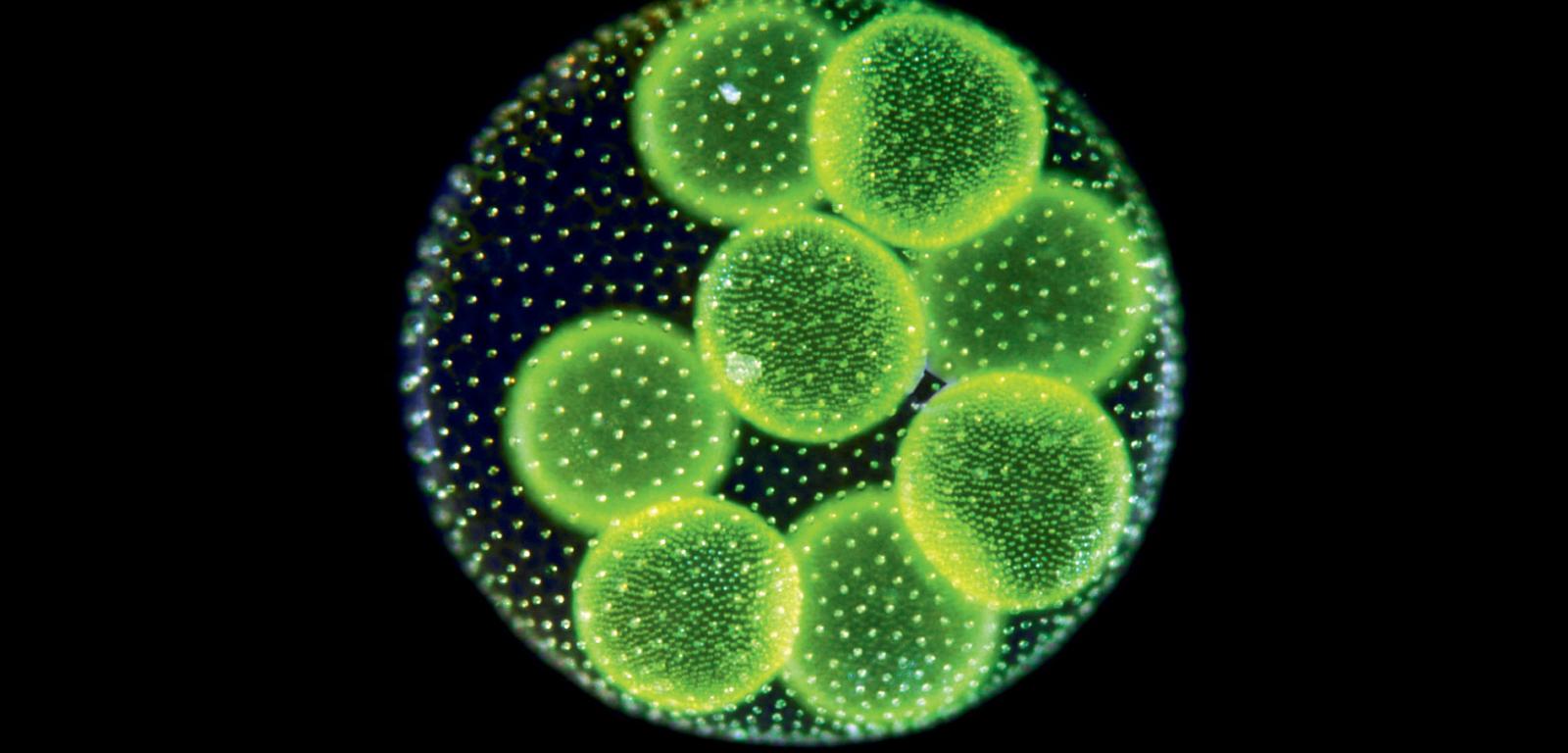 Kolonia jednokomórkowych glonów (mikroalg) należących do grupy zielenic.