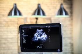 Nieprawidłowości rozwojowe płodu to za każdym razem osobisty dramat kobiety i odpowiedzialność lekarza, który się nią opiekuje. To dylematy i wybory, również etyczne, które trudno jednoznacznie rozstrzygać.