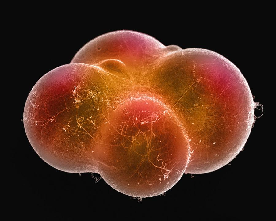Adipocyty widziane w skaningowym mikroskopie elektronowym.