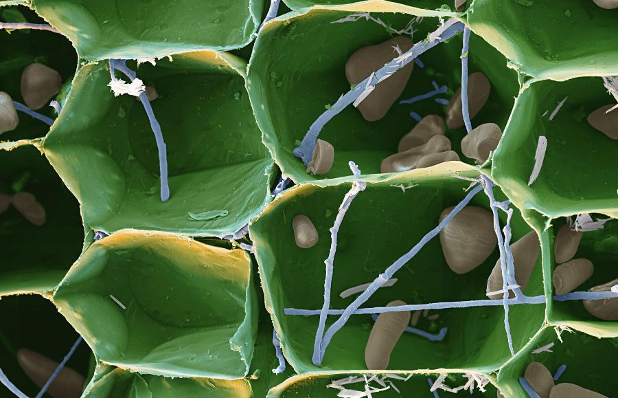 Mikroskopowe zdjęcie grzyba Fusarium oxysporum (niebieski) w tkankach liścia bananowca.
