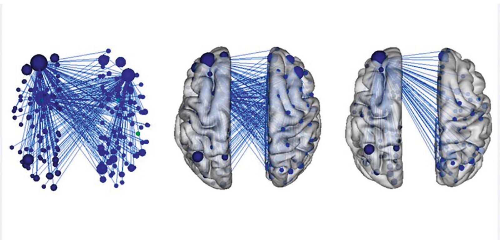 Połączenia (linie) pomiędzy poszczególnymi rejonami mózgu (kropki) zaangażowanymi w zachowania agresywne.