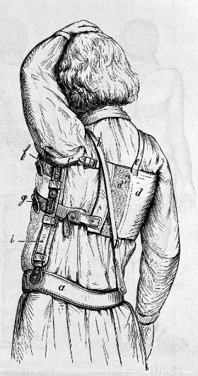 Aparat niemieckiego ortopedy Carla Hermanna Schildbacha do rozciągania. II poł. XIX w.