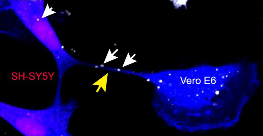 Wirus SARS-CoV-2 (wskazany białymi strzałkami) przedostaje się z zainfekowanej komórki Vero E6 t do komórki SH-SY5Y za pośrednictwem nanorurki (żółta strzałka).