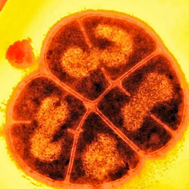 Deinococcus radiodurans