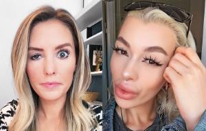 Influencerki Whitney i Elena prezentują swe oblicza po przejściach botoksowych. Nakłucia w niewłaściwe miejsca czy w niewłaściwej dawce dają takie efekty.