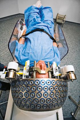 Gamma Knife to jedno z urządzeń, dzięki którym można likwidować zmiany chorobowe bez rozcinania czaszki.
