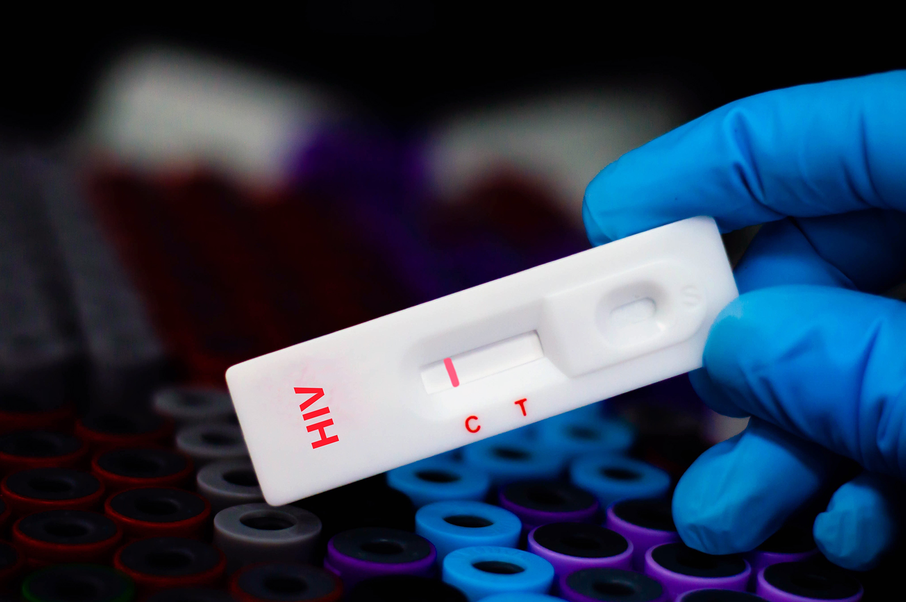 Nowy pomysł na szybkie nieinwazyjne testy na HIV. Potencjalnie można wykryć wirusa w ślinie