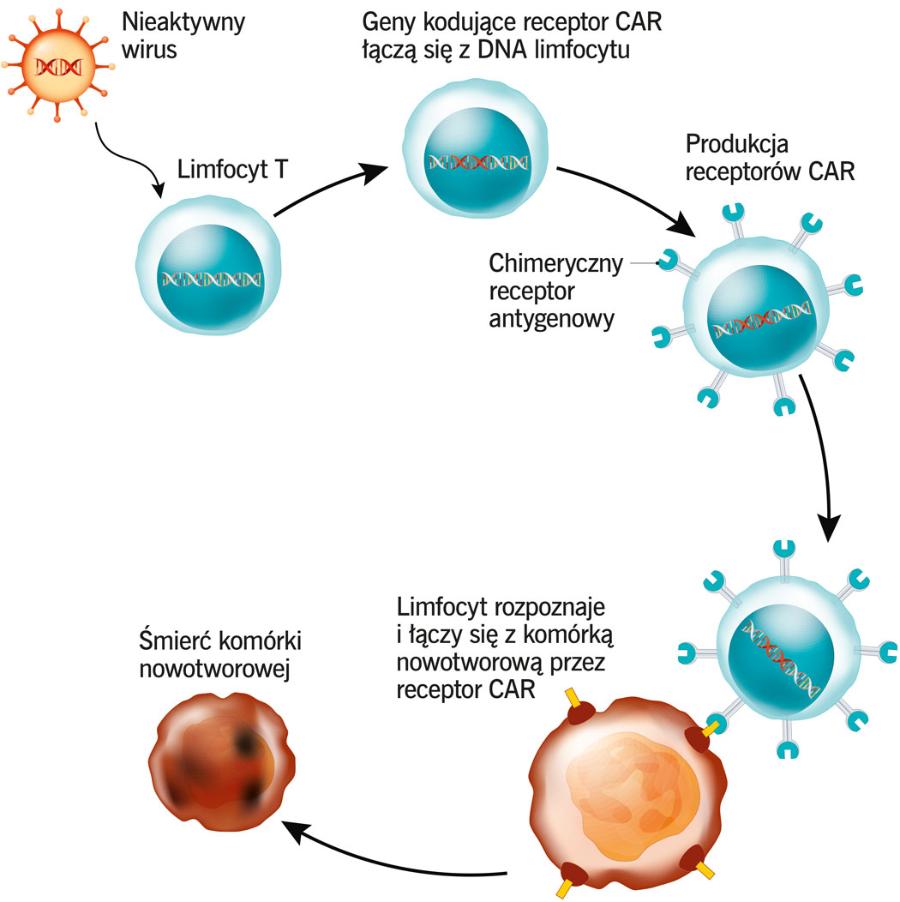 Terapia CAR-T wykorzystuje ­przeprogramowane limfocyty chorego, które efektywniej zabijają ­komórki nowotworu.