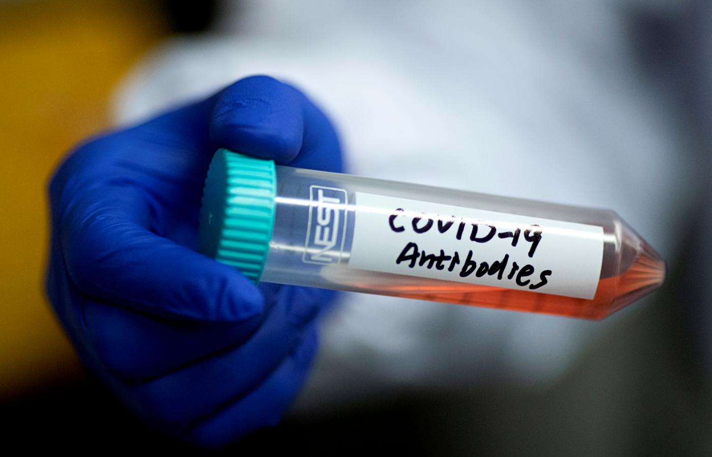 Roztwór z przeciwciałami Covid-19. Laboratorium Centrum Badań Zdrowia Publicznego w Pekinie