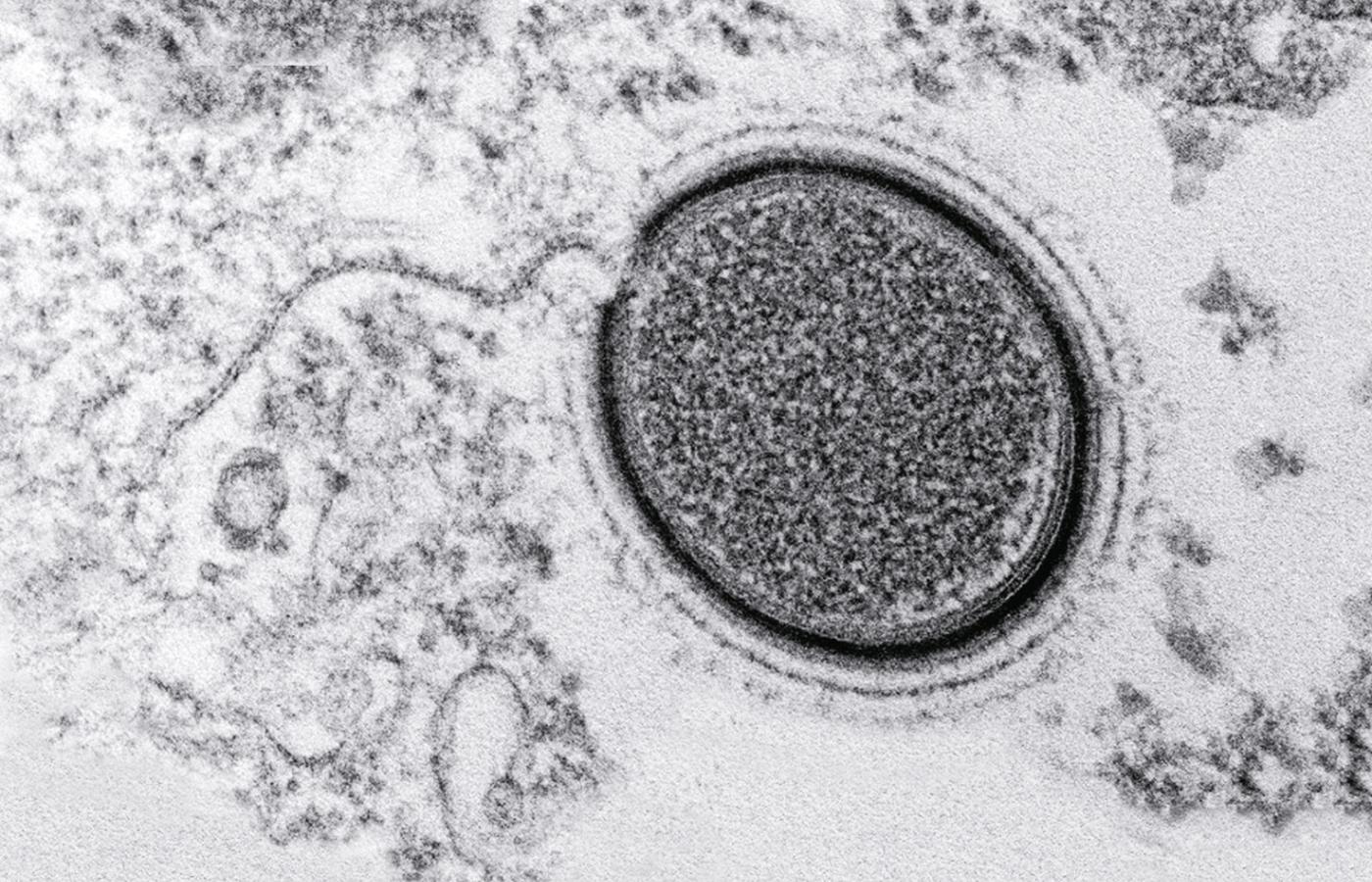 Mollivirus sibericum – wirus sprzed 30 tys. lat odkryty w 2015 r. w syberyjskiej wiecznej zmarzlinie.
