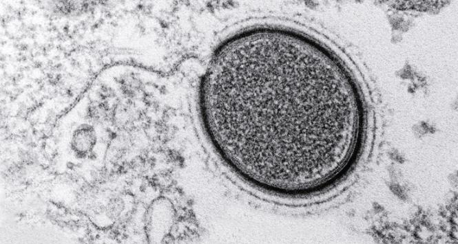 Mollivirus sibericum – wirus sprzed 30 tys. lat odkryty w 2015 r. w syberyjskiej wiecznej zmarzlinie.