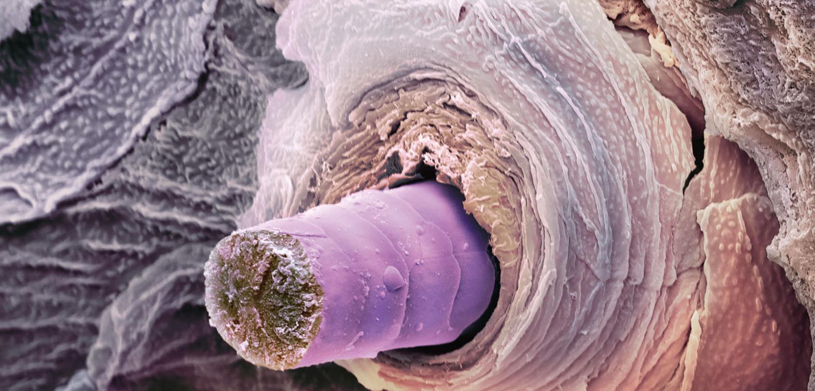 Pokolorowane zdjęcie (spod skaningowego mikroskopu elektronowego) poprzecznego przekroju łodygi włosa (fioletowy) i mieszka włosowego, w którym włos jest zakotwiczony.